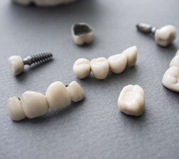 Union The Difference Between Dental Implants and Mini Dental Implants